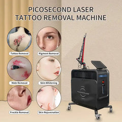 Pico Laser 750Ps Picosecond Q Switched Nd Yag Laser 1064Nm 532Nm 755Nm Tattoo Removal Picosecond Laser Machine