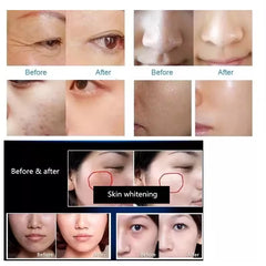 Hotsell Professional Portable Needle PRP meso hair grow wrinkle remover machine With Vacuum Mesotherapy Beauty equipment