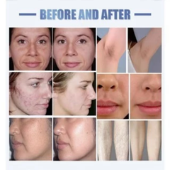 360 IPL laser hair removal machine OPT Whitening and rejuvenation beauty machine Freezing Point Hair Removal Device Beauty Instrument