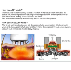 80K RF Face lifting and wrinkle removal face and body Slimming beauty Machine 80k hz Cavitation Ultrasonic Radio Frequency Machine