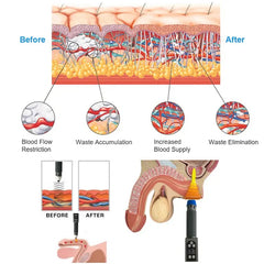 Physiotherapy Body Massage Shockwave Physical Therapy Machine ESWT pneumatic shock wave therapy machine for ED
