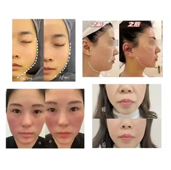 360 Ultrasonic Fat Knife Emtone Facelift Fat Reduction Wrinkle Removal Ultrasonic Facial Lifting and Firming Machine