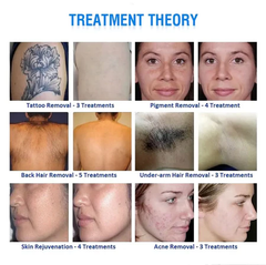 T7 2 in1 Pico Laser machine Tattoo Removal+diode laser hair removal Skin Rejuvenation Beauty machine