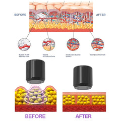 Physiotherapy Body Massage Shockwave Physical Therapy Machine ESWT pneumatic shock wave therapy machine for ED