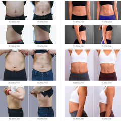 Professional Ems Rf Slim Machine Muscle Stimulate Build Fat Burn Weight Loss 14 Tesla Body Shape Sculpt Ems Nova Neo