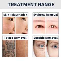 Desktop picosecond laser professional tattoo pigment removal carbon peeling picolaser tattoo All Color Tattoo Removal