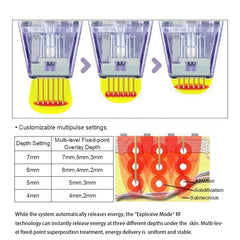 Best selling Fractional Rf Microneedling Machine For Scar Removal Top Quality Face Lifting Wrinkle Mark Removal Machine
