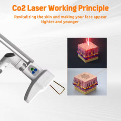 4D Co2 Fractional Laser Machine Fotona 4d Erbium Yag Laser 2940 Fotona Laser Fraccionado Co2 Dermatology Equipment