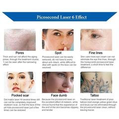 pico laser machine permanent tattoo removal Nd Yag carbon laser machine Picosecond Laser whitening