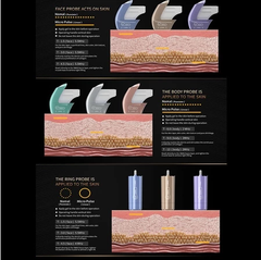 12D mini hifu facial machine slimmer face anti aging lifting device face lifter skin firming v shape