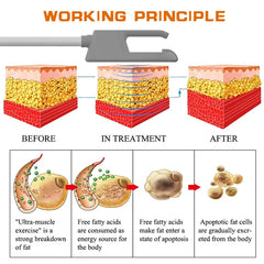 New Arrivals 5 Handle Rf Body Sculpting Machine Muscle Building Neo RF Muscle Building Body Slimming Body Sculpting Machine