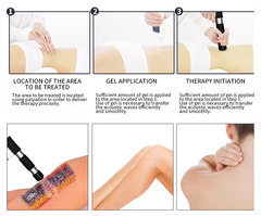 Portable Pain Relief Physical Therapy Focused Extracorporeal Shockwave Therapy Machinee