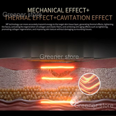 3in1 Skin Tightening Reshape Facial Lift 360° Wrinkle Removal Anti-age Machine