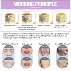 Pico laser carbon machine super picosecond 755nm and scar freckle Mole removal beauty machine