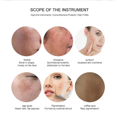 Super Picosecond laser 532nm 785nm 1064nmr machine for Tattoo Removal Freckle RemovalQ Switch Nd Yag Laser