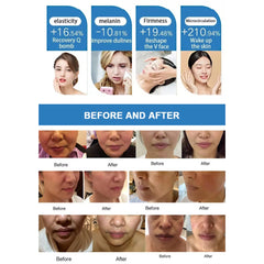 Professional Focused High-intensity Rf Sofwave Beauty Machine Facial Lifting Anti Wrinkled Body Face Removal Skin Care Products