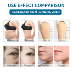 Portable 6 in 1 Skin Tightening Face Lifting Weight Loss Fat Burner RF Lipocavitation Body Sculpt 40K Weight Loss Cavit Machine