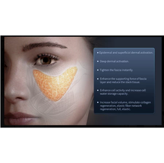 12D MAX hifu facial machine slimmer face anti aging lifting device face lifter skin firming v shape