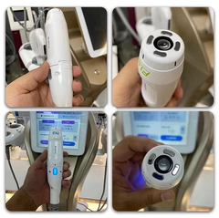 DDMay MFU+RF slimming machine for body and face 7D hifu facial machine anti aging face lifting device