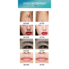 808 Diode Laser Beauty Machine Skin Rejuvenation Laser Hair Removal for Face and Body Permanent Epilation Laser