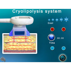 Cryo Electroporation Beauty Machine For Tightening At Removal Slimming Machine Vacuum Weight Loss Machine At Removal Slimming