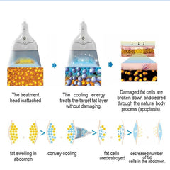 4D Sculpt 360 Cryolipolysis Fat Freezing Cool Ems Slimming Body Sculpt Machine