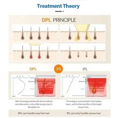 Korea DPL laser hair removal Photorejuvenation Whitening and lightening hair removal beauty machine