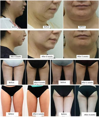 5 in 1 Beauty Equipment Roller Massage Roller Heads Cavitation Vacuum Radio Frequency Body Massage Rf Slimming Machine For Salon