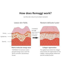 40.68Mhz Portable Ther Flx Fractional RF Skin Rejuvenation Face Lifting Tighten Wrinkle Removal Beauty Machine