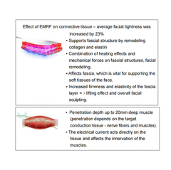 Firming face Muscle Shaping Sculpting Radio Frequency Skin Tightening Face Lift EMS beauty machine