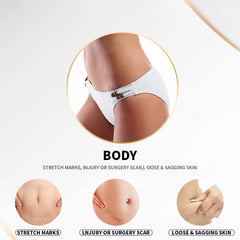 2 In 1 Skin Lifting Gold RF Ice Hammer Fractional rf Microneedling Face rf Microneedling With Cold Hsmmer /Gold Micro Needle Skin Rollar Acne Scar Stretch Mark Removal Treatment Be