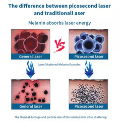 Desktop picosecond laser professional tattoo pigment removal carbon peeling picolaser tattoo All Color Tattoo Removal
