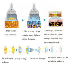 4d Cryo Machine 360 Cryolipolysis Cryo Air Cooling Machine Cryo Lipolise Cryolipolisis Fat Freezing Machine Air Cooling System