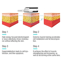 EMS machine muscle stimulator fat burning machine Fat Non-Invasive Fat Reduction bodysculpting Gain muscle and lose fat radio frequency slimming machine
