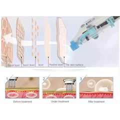 Hotsell Professional Portable Needle PRP meso hair grow wrinkle remover machine With Vacuum Mesotherapy Beauty equipment