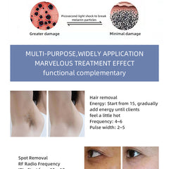 808nm Diode pico laser machine for hair removal and tattoo removal 808 pico 2 in 1