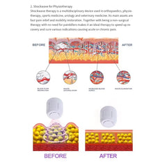 Hot sales ED Device 8 Bar Cellulite therapy erectile dysfunction shock wave Massage Radial Shock wave Ultrasound machine