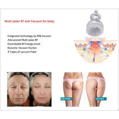 Newest 6 In 1 Lipo Laser Weight Loss Vacuum Cavitation RF Skin Firming EMS Face Lifting Cavitation System