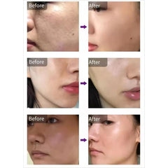 3 in 1 Mesotherapy Dermashine Pro 4th Skin Tightening Anti-aging 9 Needle Injector Mesotherapy Machine Facial Injection G-un