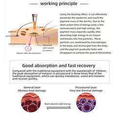 808nm Diode pico laser machine for hair removal and tattoo removal 808 pico 2 in 1