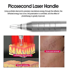 pico laser machine permanent tattoo removal Nd Yag carbon laser machine Picosecond Laser whitening