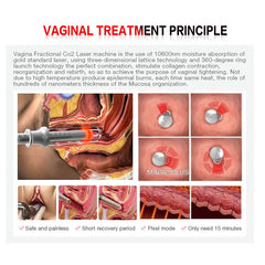 Top Selling Portable Laser Co2 Fractional / Co2 Fractional Laser / Fractional Co2 Laser Machine For Skin Rejuvenation