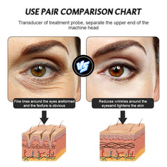 M8 Desktop Microneedl Rf Fractional Rf Microneedle Face Lifting Stretch Mark Disposable Nano Chip Rf Microneedle