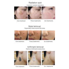 Pico Laser Machine Co2 Fractional laser Machine Skin Resurfacing Pigment Spots Removal Laser machine