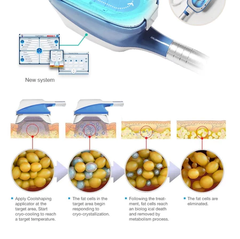 360 Cryolipolysis Cool Tech 9in1 Cryo Fat Freeze Vacuum Suction Sculpting Body Slimming machine