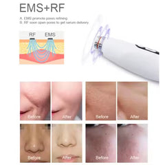 Professional Mesotherapy Mesotherapy G un Skin Firming Skin Moisturizer Lift-Plainless Needle Free Injector Gun+EMS Nano Mesogun+Nano Mesotherapy Machine