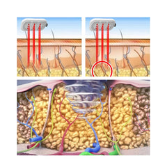 3 In 1 Fat Reduction Body Slim Machine Red Light+RF+EMS Slimming Body Shaping Beauty Machine