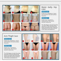 Newest 12d Max Hifu Machine Cartridge Ultramicro Ultrasound Mptst Smas Facial Lift Body Slim Shape Anti Wrinkle Removal