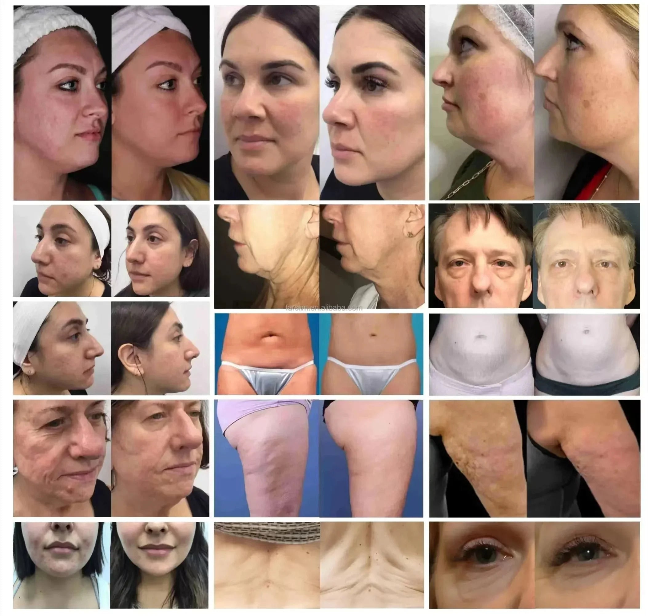 Facial machine
