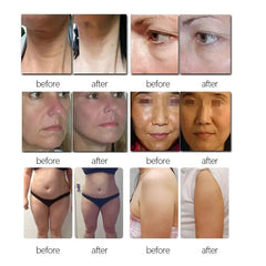 New Technology thermage Beauty Face Lift Ultrasound  Anti-wrinkle 7d Hifu V.aginal Tightening 4d Hifu 9D Body Slimming Skin Rejuvenation Machine